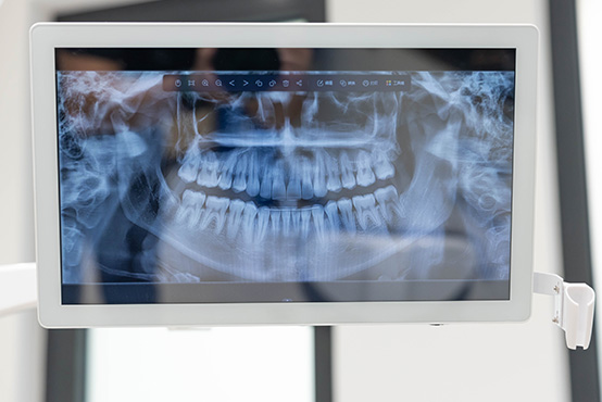 Southern Connecticut Oral Maxillofacial Surgery Implantology